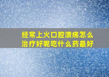 经常上火口腔溃疡怎么治疗好呢吃什么药最好