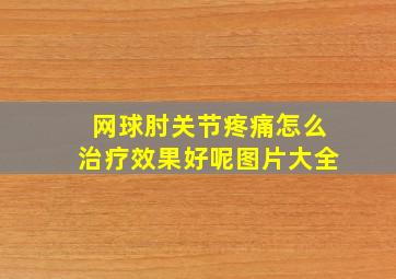 网球肘关节疼痛怎么治疗效果好呢图片大全