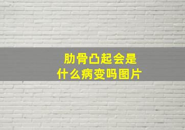 肋骨凸起会是什么病变吗图片