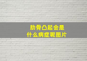 肋骨凸起会是什么病症呢图片