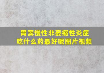 胃窦慢性非萎缩性炎症吃什么药最好呢图片视频