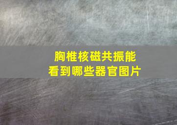 胸椎核磁共振能看到哪些器官图片