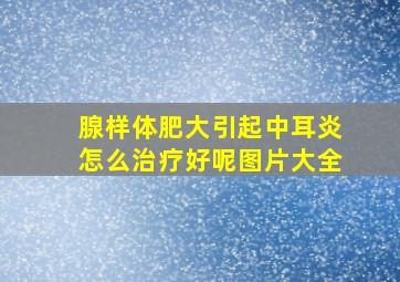 腺样体肥大引起中耳炎怎么治疗好呢图片大全