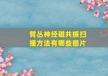 臂丛神经磁共振扫描方法有哪些图片