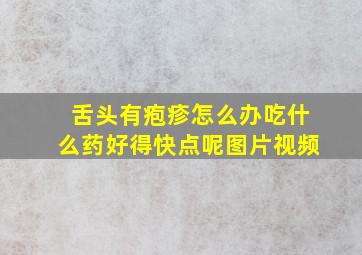 舌头有疱疹怎么办吃什么药好得快点呢图片视频