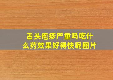 舌头疱疹严重吗吃什么药效果好得快呢图片