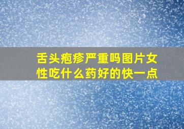 舌头疱疹严重吗图片女性吃什么药好的快一点