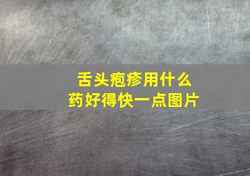 舌头疱疹用什么药好得快一点图片