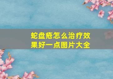 蛇盘疮怎么治疗效果好一点图片大全