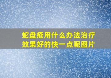 蛇盘疮用什么办法治疗效果好的快一点呢图片