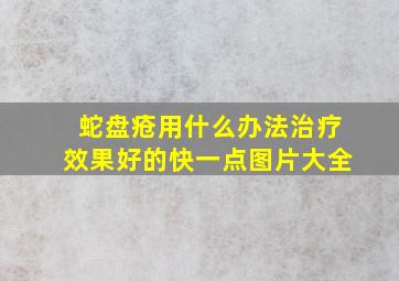 蛇盘疮用什么办法治疗效果好的快一点图片大全