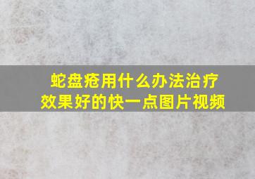 蛇盘疮用什么办法治疗效果好的快一点图片视频