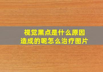 视觉黑点是什么原因造成的呢怎么治疗图片