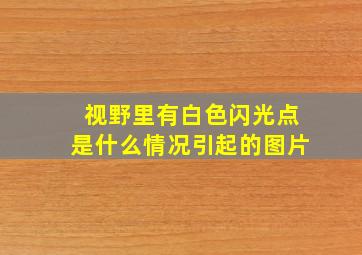 视野里有白色闪光点是什么情况引起的图片