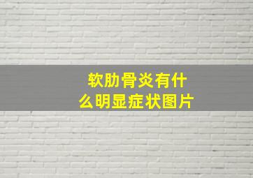 软肋骨炎有什么明显症状图片