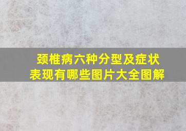 颈椎病六种分型及症状表现有哪些图片大全图解