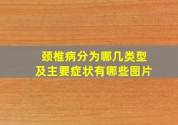 颈椎病分为哪几类型及主要症状有哪些图片