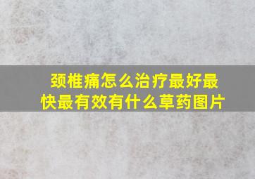 颈椎痛怎么治疗最好最快最有效有什么草药图片