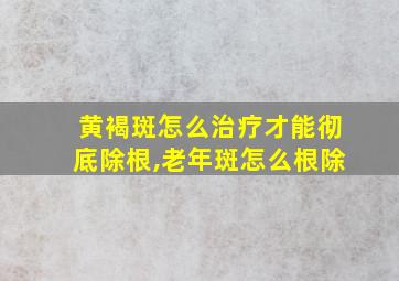 黄褐斑怎么治疗才能彻底除根,老年斑怎么根除