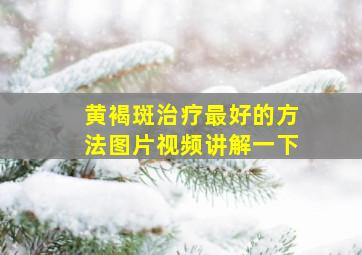 黄褐斑治疗最好的方法图片视频讲解一下