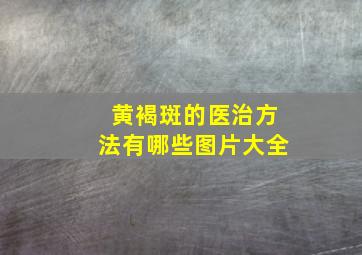 黄褐斑的医治方法有哪些图片大全