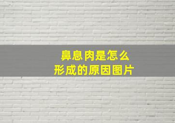 鼻息肉是怎么形成的原因图片