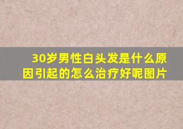 30岁男性白头发是什么原因引起的怎么治疗好呢图片