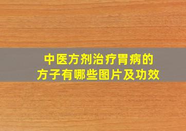 中医方剂治疗胃病的方子有哪些图片及功效