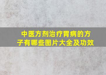 中医方剂治疗胃病的方子有哪些图片大全及功效