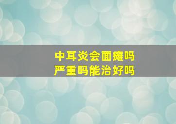 中耳炎会面瘫吗严重吗能治好吗