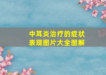 中耳炎治疗的症状表现图片大全图解