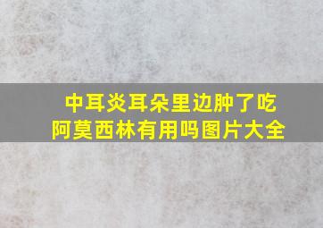 中耳炎耳朵里边肿了吃阿莫西林有用吗图片大全