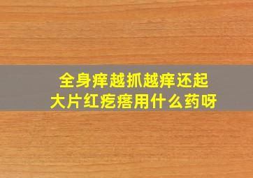 全身痒越抓越痒还起大片红疙瘩用什么药呀