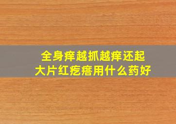 全身痒越抓越痒还起大片红疙瘩用什么药好