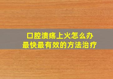 口腔溃疡上火怎么办最快最有效的方法治疗