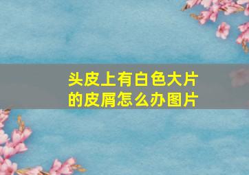 头皮上有白色大片的皮屑怎么办图片