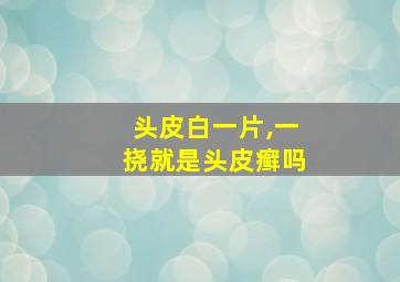 头皮白一片,一挠就是头皮癣吗