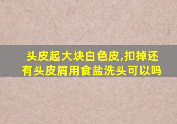 头皮起大块白色皮,扣掉还有头皮屑用食盐洗头可以吗