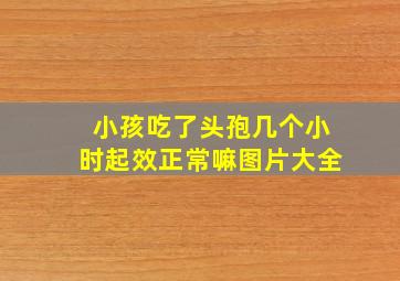 小孩吃了头孢几个小时起效正常嘛图片大全