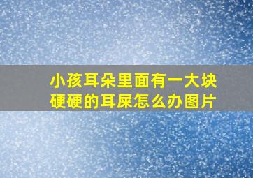 小孩耳朵里面有一大块硬硬的耳屎怎么办图片