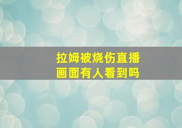 拉姆被烧伤直播画面有人看到吗