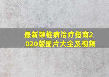 最新颈椎病治疗指南2020版图片大全及视频