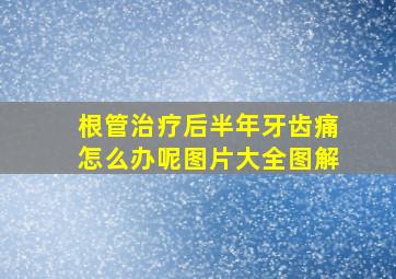 根管治疗后半年牙齿痛怎么办呢图片大全图解