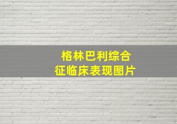 格林巴利综合征临床表现图片