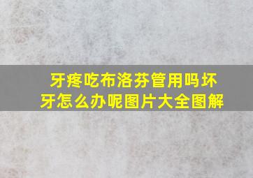 牙疼吃布洛芬管用吗坏牙怎么办呢图片大全图解