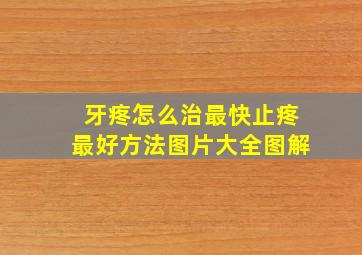 牙疼怎么治最快止疼最好方法图片大全图解