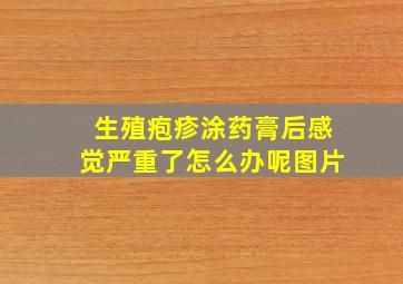 生殖疱疹涂药膏后感觉严重了怎么办呢图片