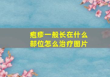 疱疹一般长在什么部位怎么治疗图片