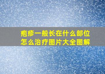 疱疹一般长在什么部位怎么治疗图片大全图解