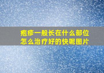 疱疹一般长在什么部位怎么治疗好的快呢图片